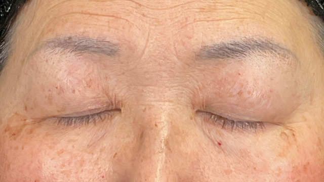 Postoperative Condition Part 1