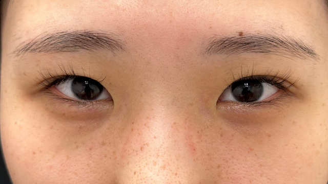 Postoperative Condition Part 1