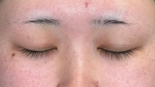 Postoperative Condition Part 1