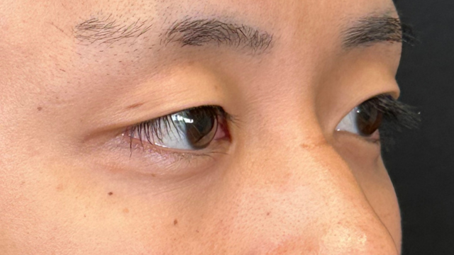 Postoperative Condition Part 1