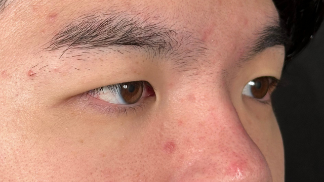 Postoperative Condition Part 1