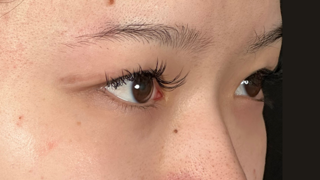 Postoperative Condition Part 1