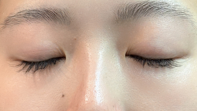 Postoperative Condition Part 1