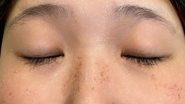 Postoperative Condition Part 1