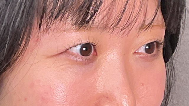 Postoperative Condition Part 1