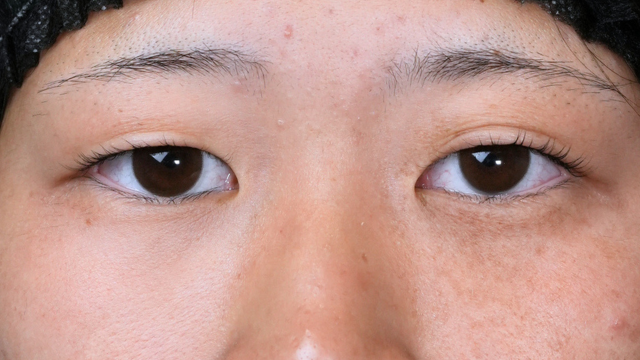 Postoperative Condition Part 1