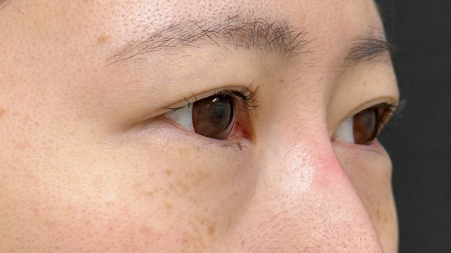 Postoperative Condition Part 1