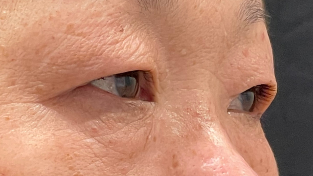 Postoperative Condition Part 1