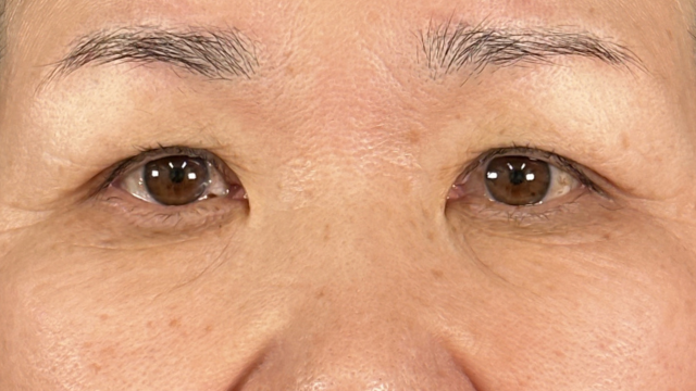 Postoperative Condition Part 1