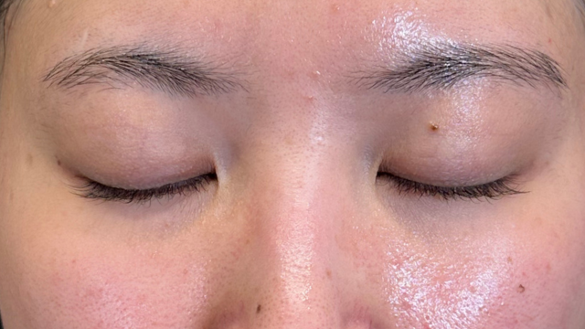 Postoperative Condition Part 1