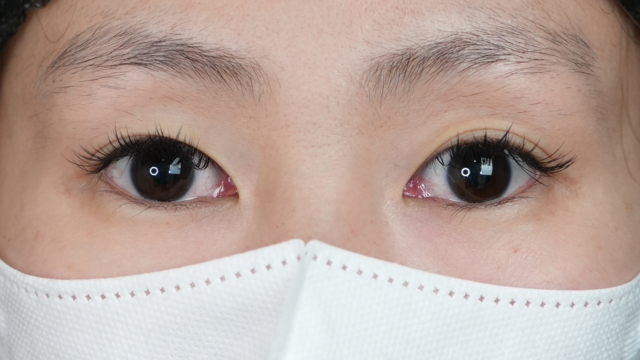 Postoperative Condition Part 1