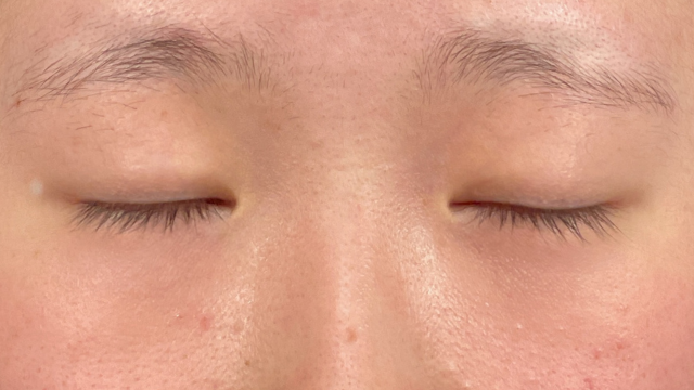 Postoperative Condition Part 1