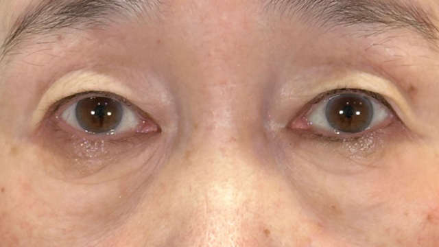 Postoperative Condition Part 1