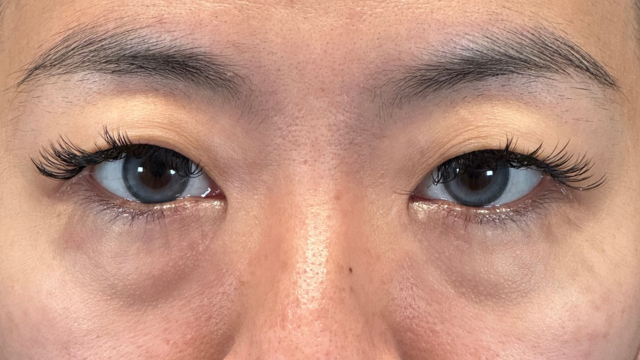 Postoperative Condition Part 1