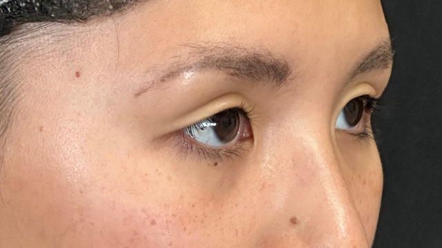 Postoperative Condition Part 1