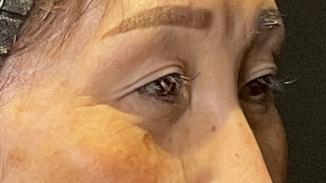 Postoperative Condition Part 1