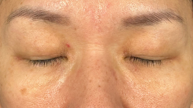 Postoperative Condition Part 1