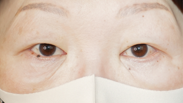 Postoperative Condition Part 1