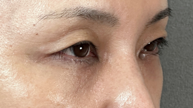 Postoperative Condition Part 1