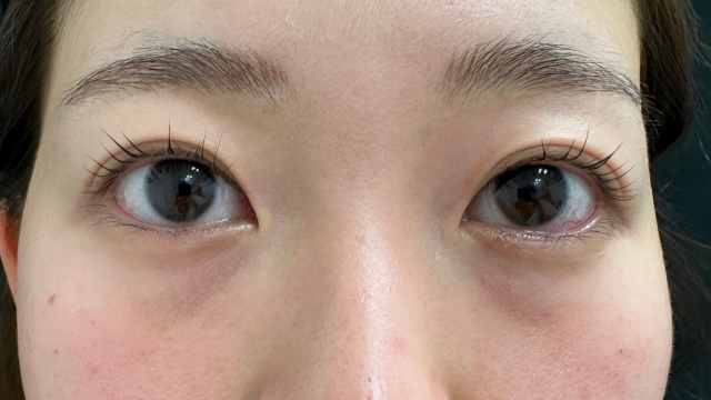 Postoperative Condition Part 1