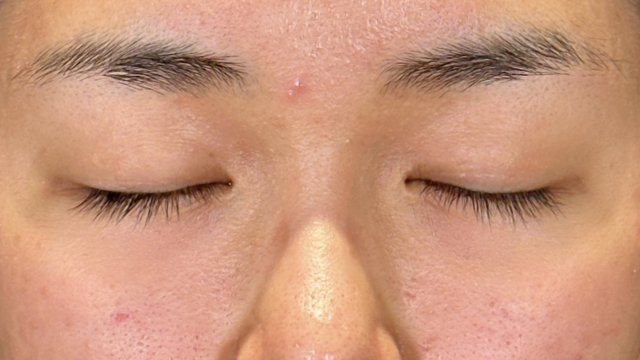 Postoperative Condition Part 1