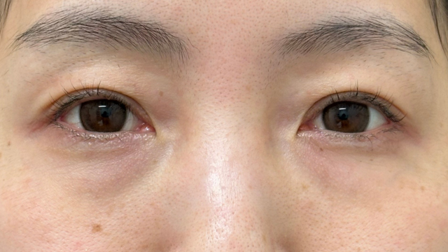 Postoperative Condition Part 1