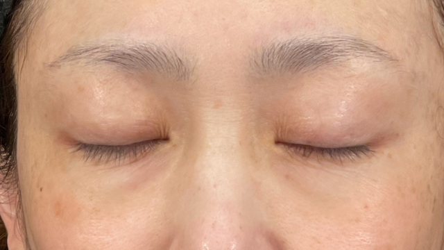 Postoperative Condition Part 1