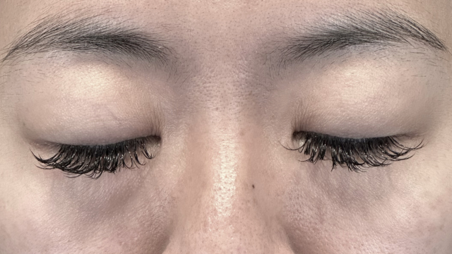 Postoperative Condition Part 1