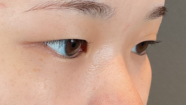 Postoperative Condition Part 1