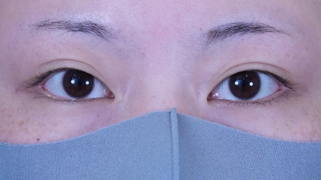 Postoperative Condition Part 1