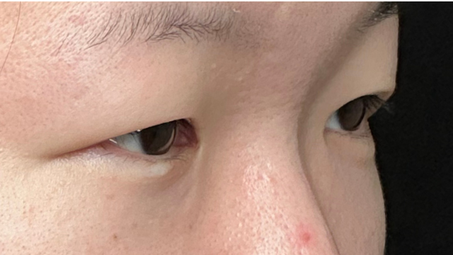 Postoperative Condition Part 1