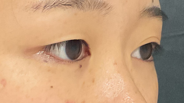 Postoperative Condition Part 1