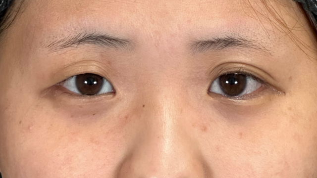 Postoperative Condition Part 1