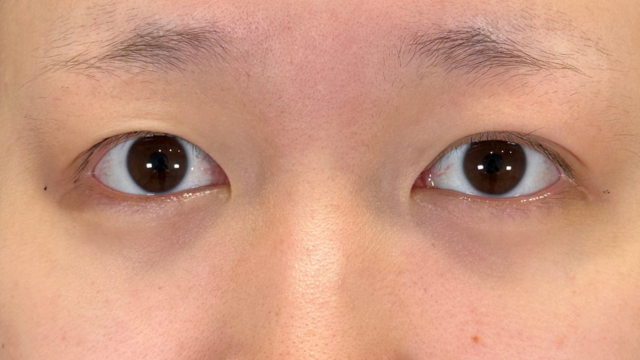 Postoperative Condition Part 1