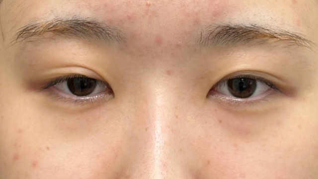 Postoperative Condition Part 1