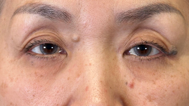 Postoperative Condition Part 1