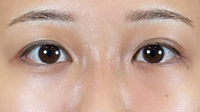 Postoperative Condition Part 1