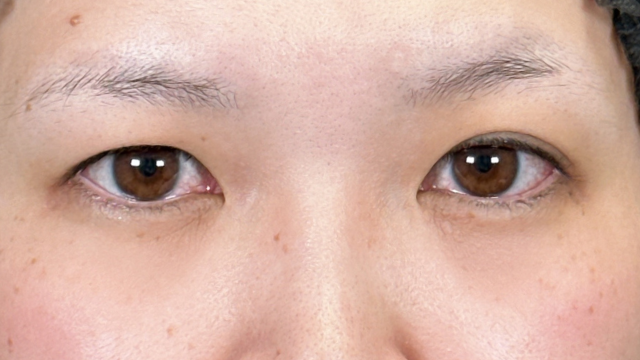 Postoperative Condition Part 1