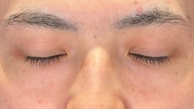 Postoperative Condition Part 1