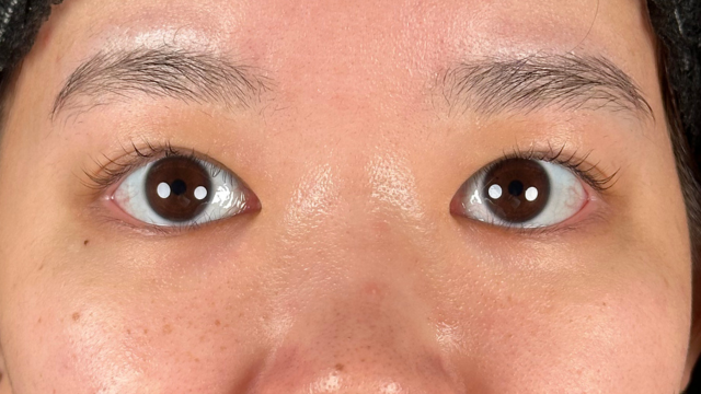 Postoperative Condition Part 1