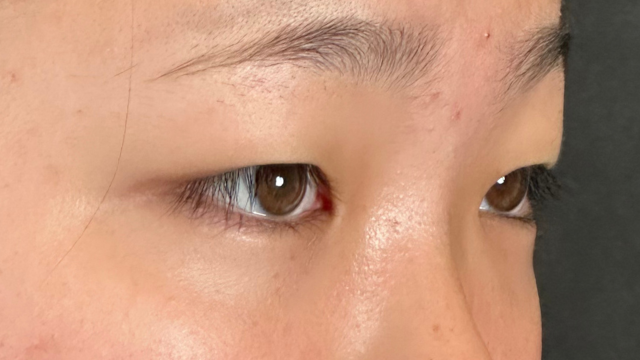 Postoperative Condition Part 1