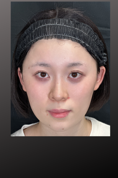 Postoperative Condition Part 1