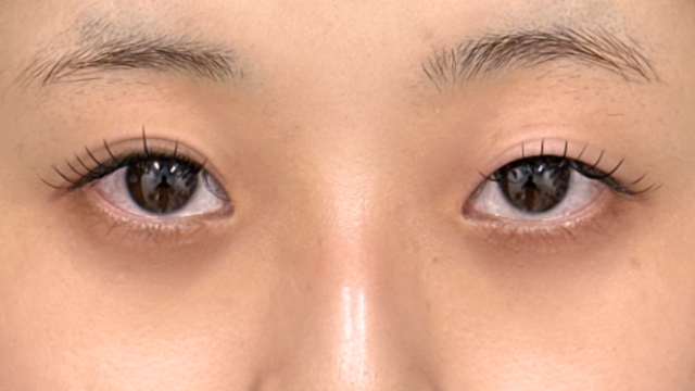 Postoperative Condition Part 1