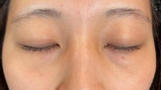 Postoperative Condition Part 1