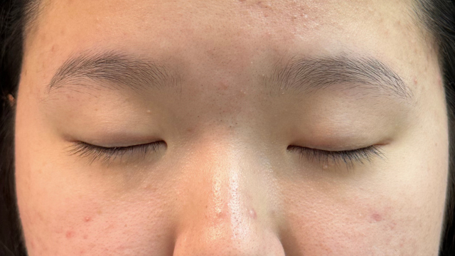 Postoperative Condition Part 1