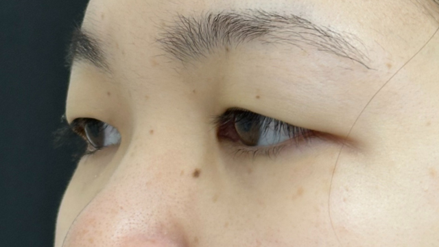 Postoperative Condition Part 1