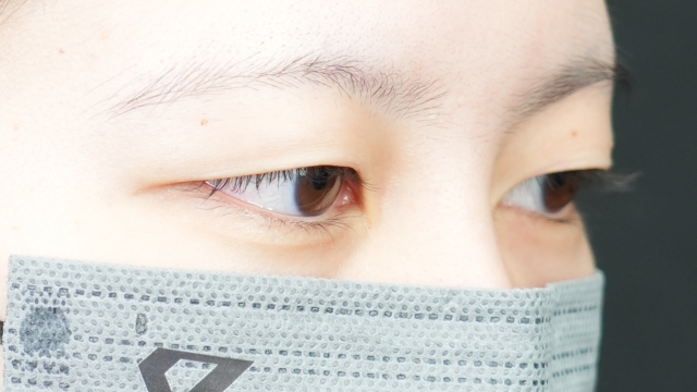 Postoperative Condition Part 1