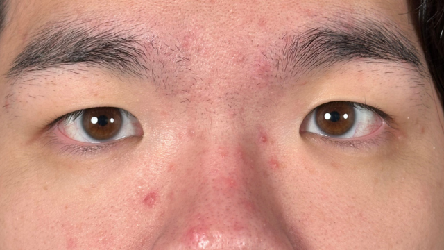 Postoperative Condition Part 1