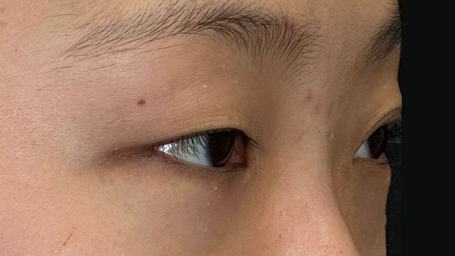 Postoperative Condition Part 1