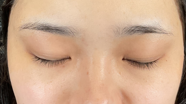 Postoperative Condition Part 1